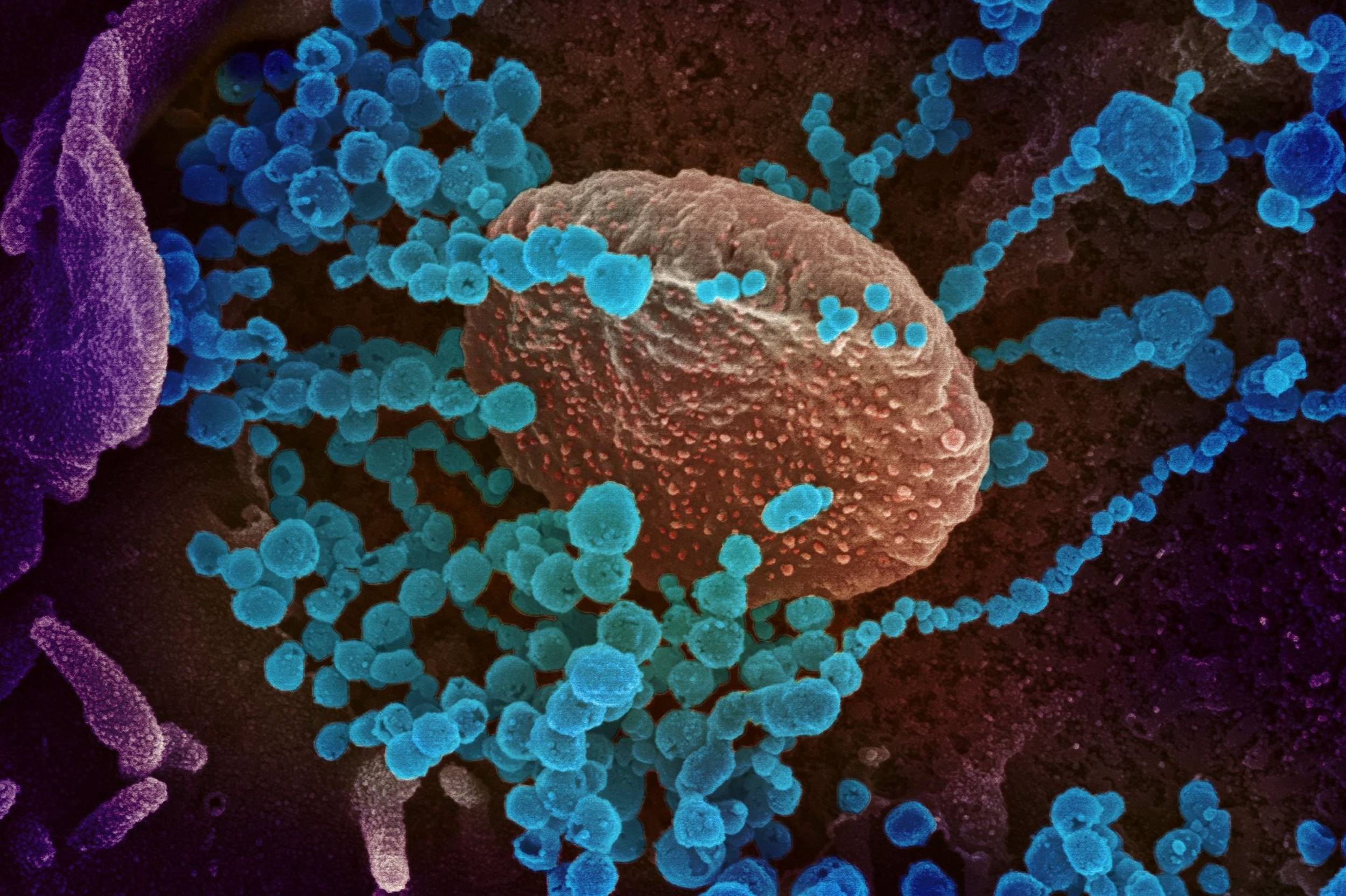 virus