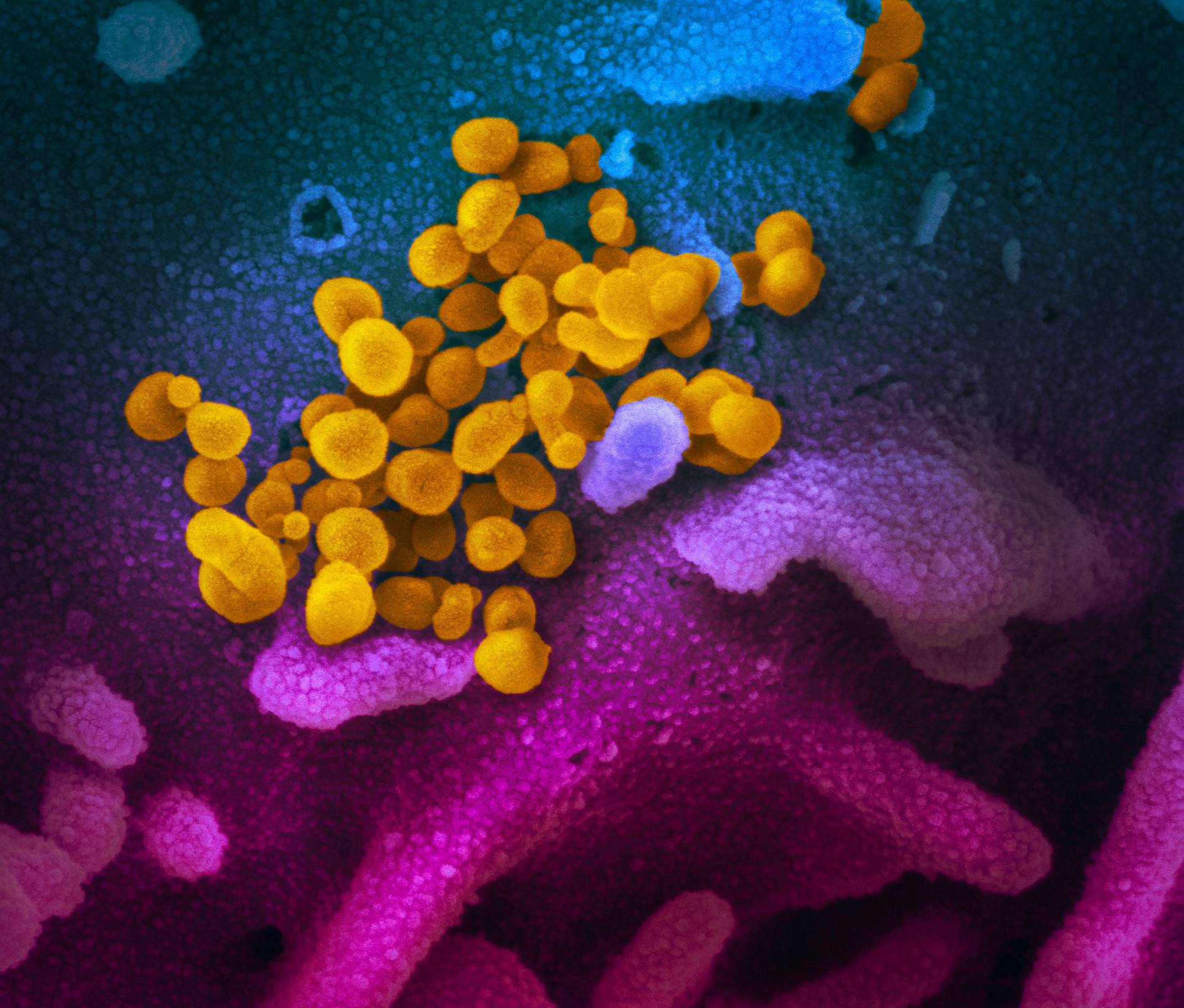 virus